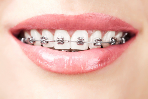 Orthodontics-Pic.jpg