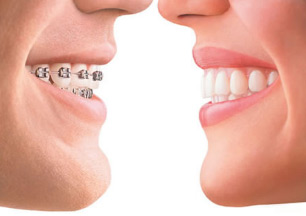 orthodontics07.jpg