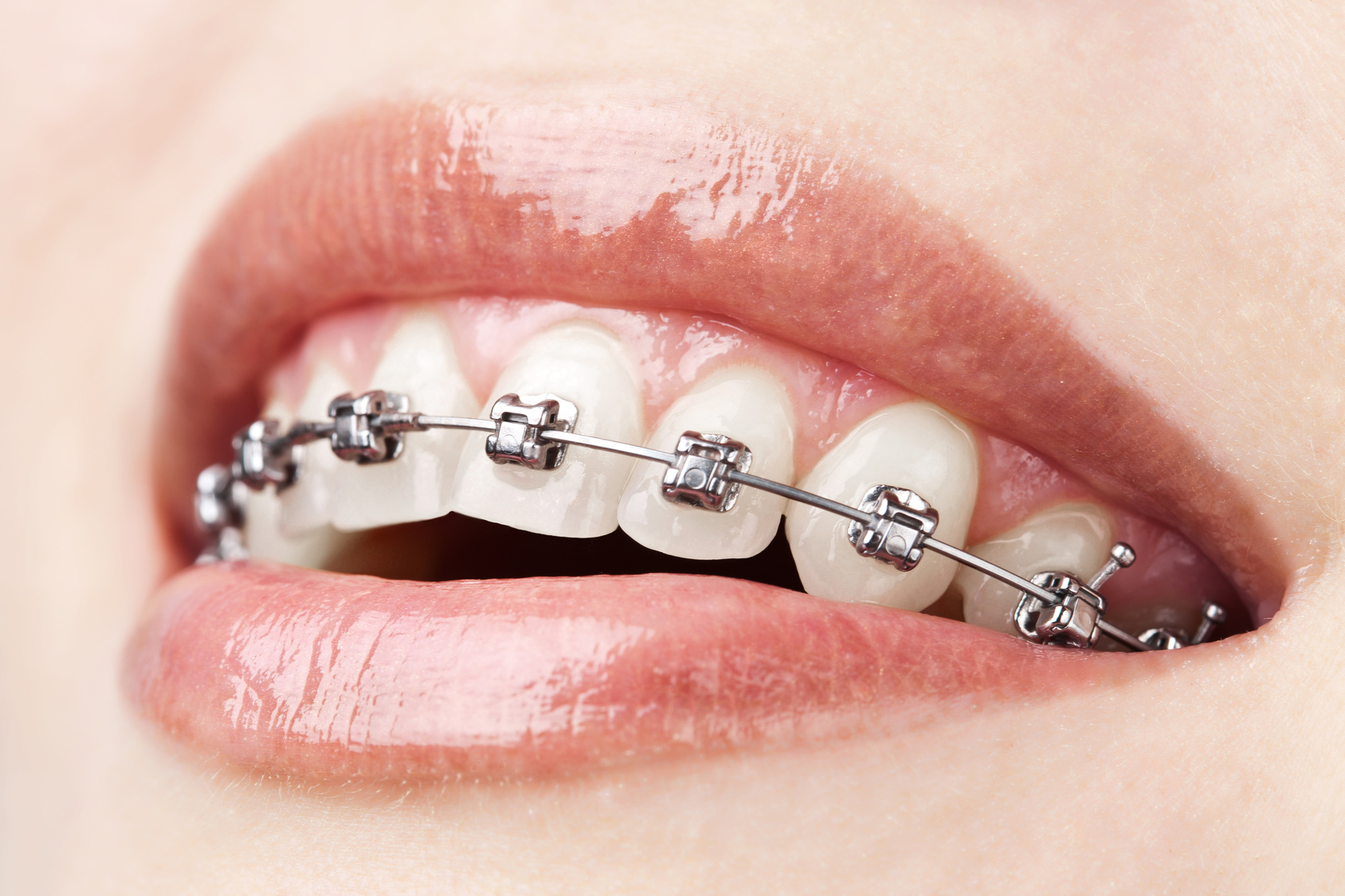 Orthodontics.jpg