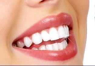 white-teeth-2.jpg