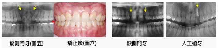 文章圖片