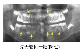文章圖片