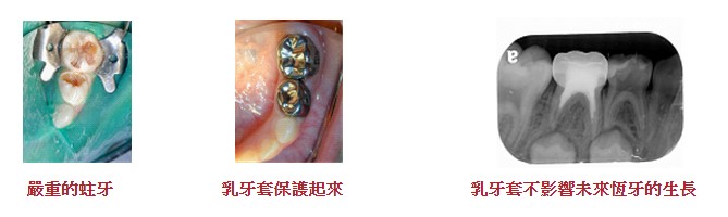 文章圖片